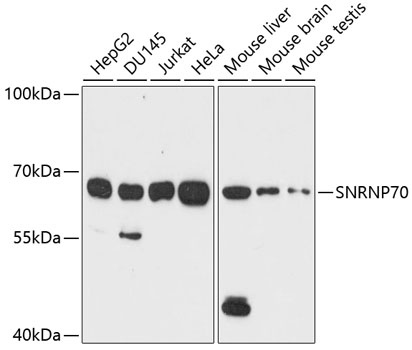 Western blot - SNRNP70 Polyclonal Antibody 