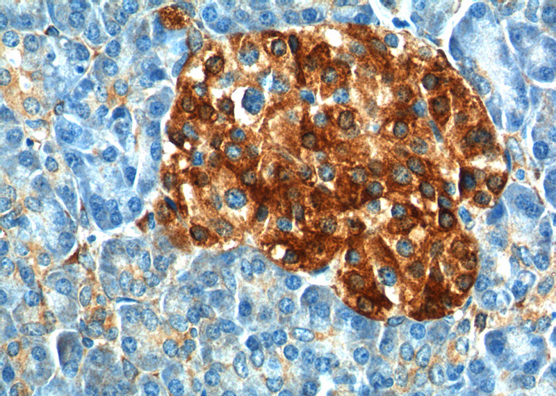 Immunohistochemistry of paraffin-embedded human pancreas tissue slide using Catalog No:116824(WFS1 Antibody) at dilution of 1:200 (under 40x lens).