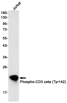 Western blot detection of Phospho-CD3 zeta (Tyr142) in Jurkat cell lysates using Phospho-CD3 zeta (Tyr142) Rabbit mAb(1:500 diluted).Predicted band size:19kDa.Observed band size:19kDa.