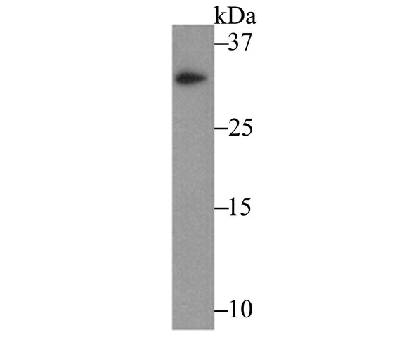 Fig1: Western blot analysis of IL-31 on recombinant protein lysate using anti-IL-31 antibody at 1/500 dilution.
