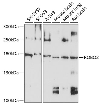 Western blot - ROBO2 Polyclonal Antibody 