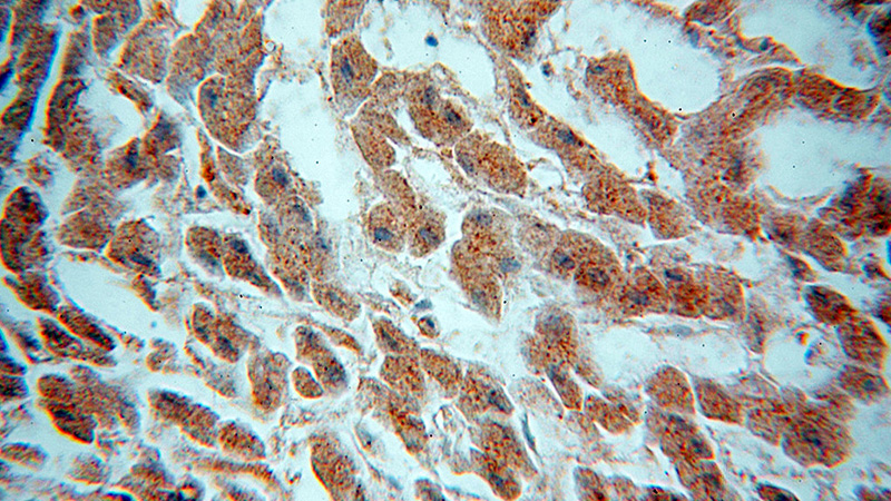 Immunohistochemical of paraffin-embedded human liver using Catalog No:107799(ADPGK antibody) at dilution of 1:50 (under 40x lens)