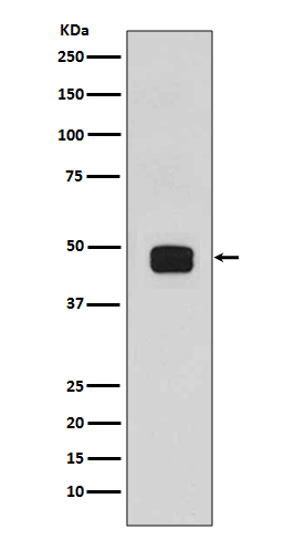 Western blot analysis of GSK3 beta (phospho S9)  expression in 293T cell lysates, treated with Calyculin A.