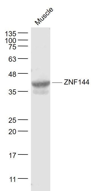 Fig2: Sample:; Muscle (Rat) Lysate at 40 ug; Primary: Anti- ZNF144 at 1/1000 dilution; Secondary: IRDye800CW Goat Anti-Rabbit IgG at 1/20000 dilution; Predicted band size: 38/60 kD; Observed band size: 38 kD