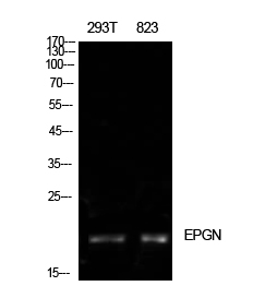 Fig1:; Western Blot analysis of 293T, 823 cells using Epigen Polyclonal Antibody. Antibody was diluted at 1:500. Secondary antibody（catalog#：HA1001) was diluted at 1:20000