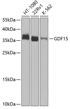 Western blot - GDF15 Polyclonal Antibody 