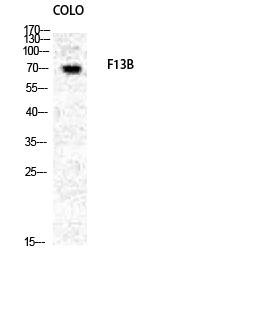Fig1:; Western Blot analysis of COLO cells using Factor XIII B Polyclonal Antibody diluted at 1: 1000