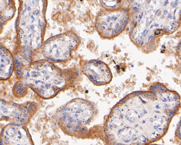 Fig7:; Immunohistochemical analysis of paraffin-embedded human placenta using anti-SYNDIG1 antibody. The section was pre-treated using heat mediated antigen retrieval with Tris-EDTA buffer (pH 8.0-8.4) for 20 minutes.The tissues were blocked in 5% BSA for 30 minutes at room temperature, washed with ddH; 2; O and PBS, and then probed with the primary antibody ( 1/400) for 30 minutes at room temperature. The detection was performed using an HRP conjugated compact polymer system. DAB was used as the chromogen. Tissues were counterstained with hematoxylin and mounted with DPX.