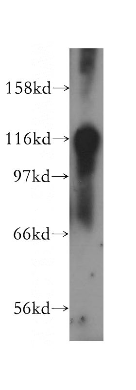mouse testis tissue were subjected to SDS PAGE followed by western blot with Catalog No:114474(RASA1 antibody) at dilution of 1:400