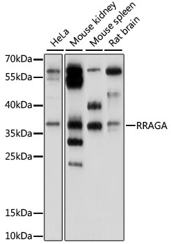 Western blot - RRAGA Polyclonal Antibody 