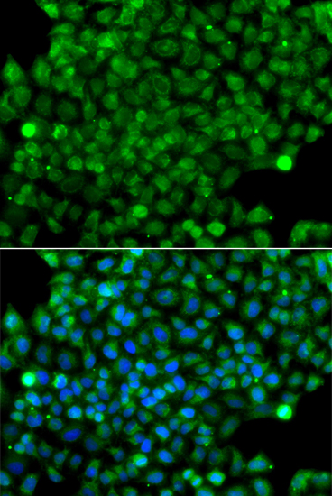 Immunofluorescence - CFHR3 Polyclonal Antibody 