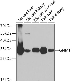 Western blot - GNMT Polyclonal Antibody 
