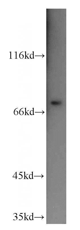 mouse skeletal muscle tissue were subjected to SDS PAGE followed by western blot with Catalog No:115052(SAMD4A antibody) at dilution of 1:500