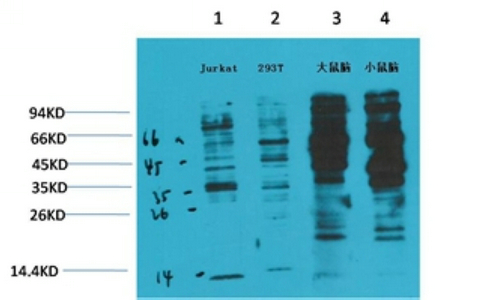 Western blot analysis of 1) Jurkat, 2) 293T, 3) Rat Brain Tissue, 4) Mouse Brain Tissue with Phosphotyrosine Mouse mAb diluted at 1:2,000
