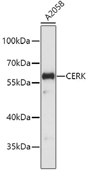 Western blot - CERK Polyclonal Antibody 