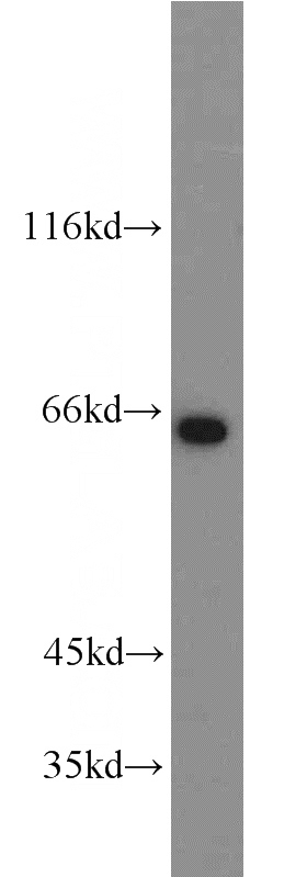 SH-SY5Y cells were subjected to SDS PAGE followed by western blot with Catalog No:111844(INPP5E antibody) at dilution of 1:1000