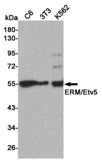Western blot detection of ERM/Etv5 in C6,3T3 and K562 cell lysates using ERM/Etv5 mouse mAb (1:500 diluted).Predicted band size:58KDa.Observed band size:58KDa.