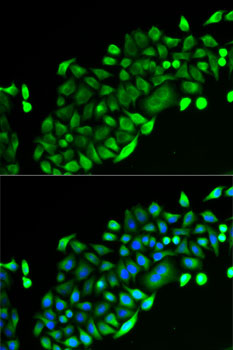 Immunofluorescence - GSTO2 Polyclonal Antibody 