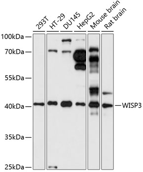 Western blot - WISP3 Polyclonal Antibody 