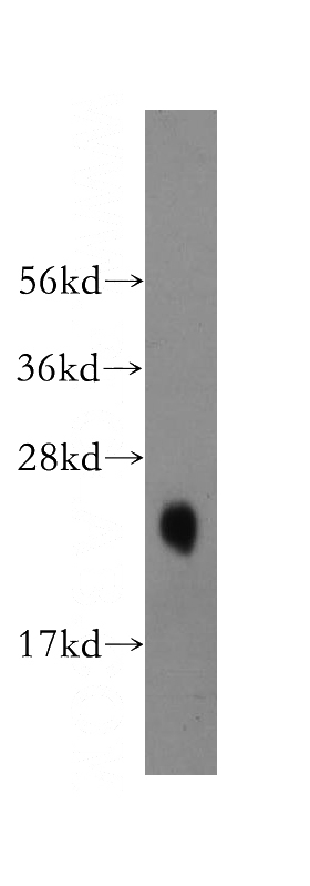 human cerebellum tissue were subjected to SDS PAGE followed by western blot with Catalog No:111965(KCNIP1 antibody) at dilution of 1:500