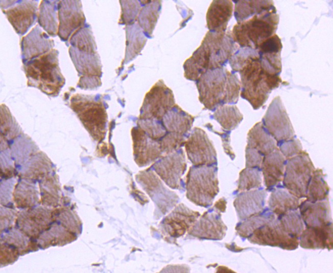 Fig1:; Immunohistochemical analysis of paraffin-embedded rat skeletal muscle tissue using anti-Plectin antibody. The section was pre-treated using heat mediated antigen retrieval with Tris-EDTA buffer (pH 8.0-8.4) for 20 minutes.The tissues were blocked in 5% BSA for 30 minutes at room temperature, washed with ddH; 2; O and PBS, and then probed with the primary antibody ( 1/50) for 30 minutes at room temperature. The detection was performed using an HRP conjugated compact polymer system. DAB was used as the chromogen. Tissues were counterstained with hematoxylin and mounted with DPX.