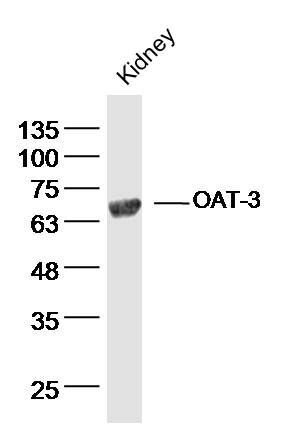 Fig1: Sample:Kidney (Mouse) Lysate at 40 ug; Primary: Anti-OAT-3 at 1/300 dilution; Secondary: IRDye800CW Goat Anti-Rabbit IgG at 1/20000 dilution; Predicted band size: 59 kD; Observed band size: 65 kD