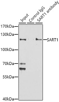 Immunoprecipitation - SART1 Polyclonal Antibody 