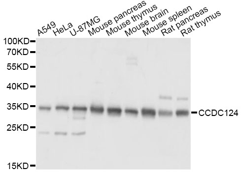 Western blot - CCDC124 Polyclonal Antibody 