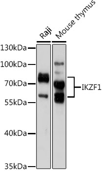 Western blot - IKZF1 Polyclonal Antibody 