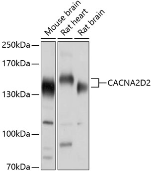 Western blot - CACNA2D2 Polyclonal Antibody 