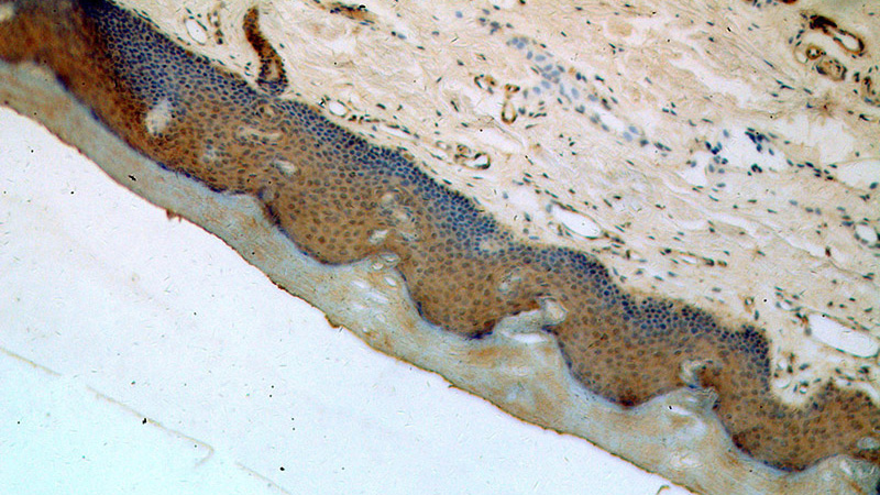 Immunohistochemical of paraffin-embedded human skin using Catalog No:116421(TRUB2 antibody) at dilution of 1:50 (under 10x lens)