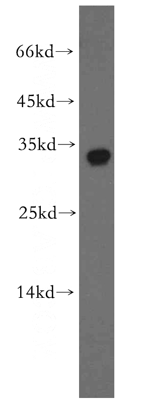 human brain tissue were subjected to SDS PAGE followed by western blot with Catalog No:108540(BTF3L3-Specific antibody) at dilution of 1:300