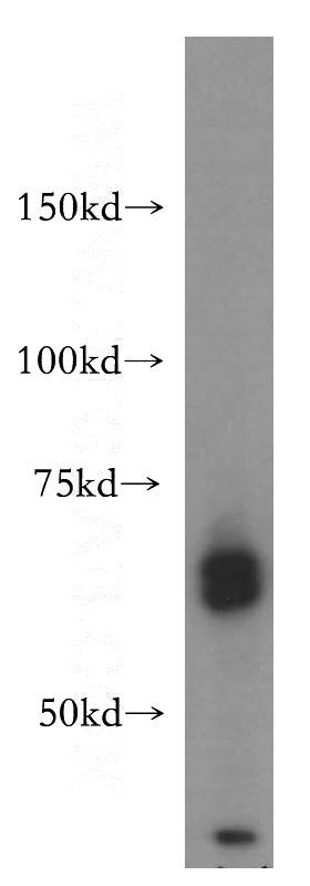 K-562 cells were subjected to SDS PAGE followed by western blot with Catalog No:109109(CDC45L antibody) at dilution of 1:500