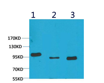 Fig1:; Western blot analysis of 1) Mouse Brain Tissue, 2) Hela, 3) Rat Brain Tissue with EphA1 Rabbit pAb diluted at 1:2,000.