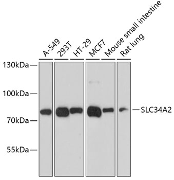 Western blot - SLC34A2 Polyclonal Antibody 