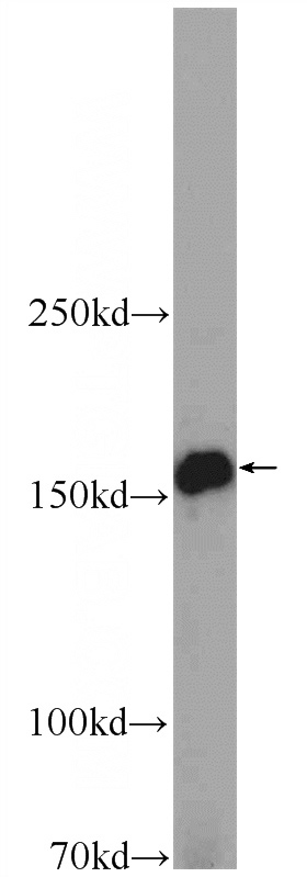 mouse placenta tissue were subjected to SDS PAGE followed by western blot with Catalog No:107770(ADAMTS12 Antibody) at dilution of 1:300