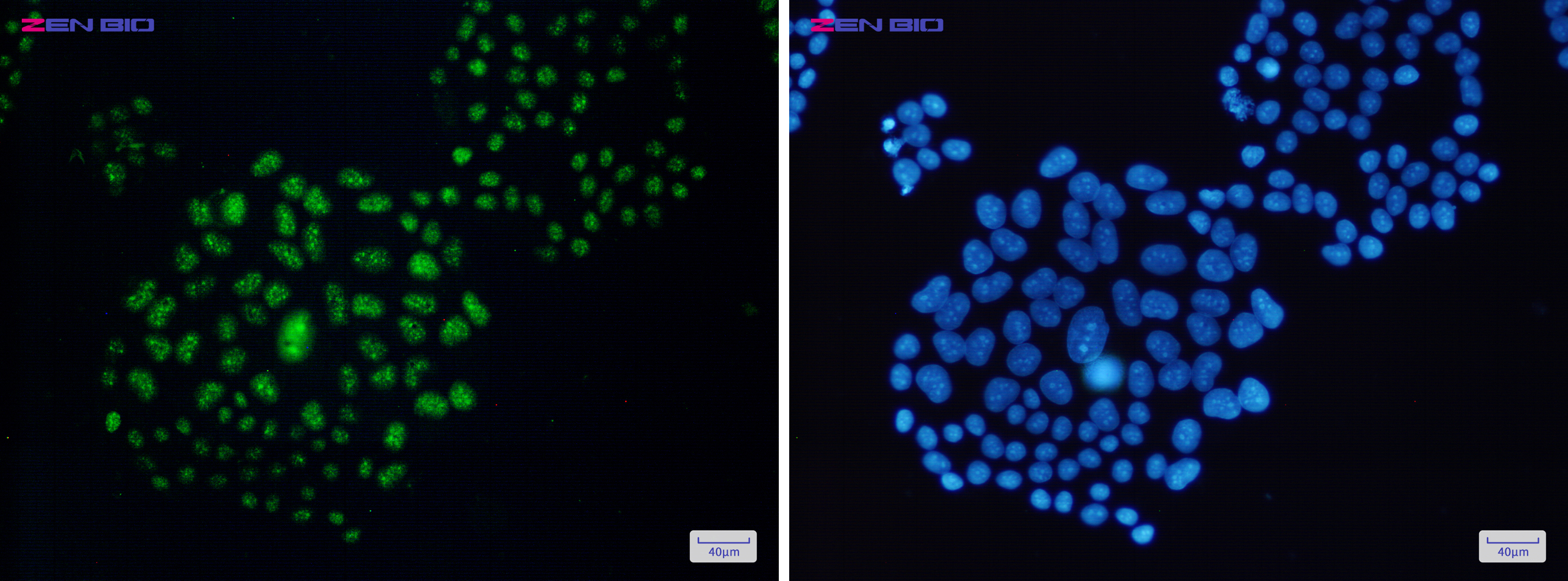 Immunocytochemistry of EWSR1(green) in Hela cells using EWSR1 Rabbit pAb at dilution 1/50, and DAPI(blue)