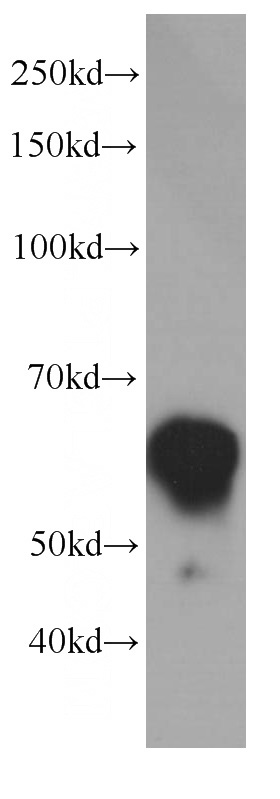Jurkat cells were subjected to SDS PAGE followed by western blot with Catalog No:107540(Vimentin Antibody) at dilution of 1:2000
