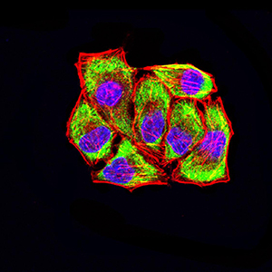 Fig4: Immunocytochemistry staining of LRP3 in Hela cells (green). Formalin fixed cells were permeabilized with 0.1% Triton X-100 in TBS for 10 minutes at room temperature and blocked with 1% Blocker BSA for 15 minutes at room temperature. Cells were probed with the primary antibody ( 1/100) for 1 hour at room temperature, washed with PBS. Alexa Fluor®488 Goat anti-Mouse IgG was used as the secondary antibody at 1/1,000 dilution. The nuclear counter stain is DAPI (blue), Actin filaments have been labeled with Alexa Fluor- 555 phalloidin (red).