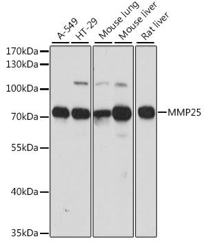 Western blot - MMP25 Polyclonal Antibody 
