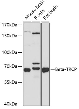 Western blot - Beta-TRCP Polyclonal Antibody 