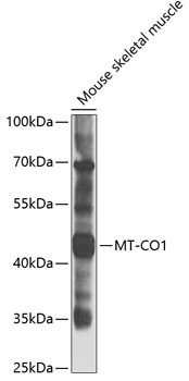 Western blot - COX1 Polyclonal Antibody 
