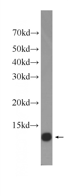 HeLa cells were subjected to SDS PAGE followed by western blot with Catalog No:107518(S100A11 antibody) at dilution of 1:1000
