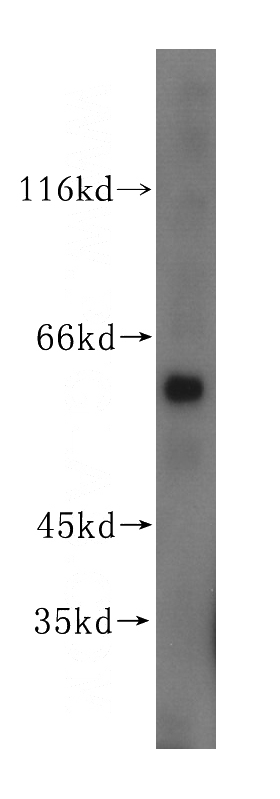 mouse liver tissue were subjected to SDS PAGE followed by western blot with Catalog No:113795(PGS1 antibody) at dilution of 1:500