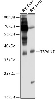 Western blot - TSPAN7 Polyclonal Antibody 