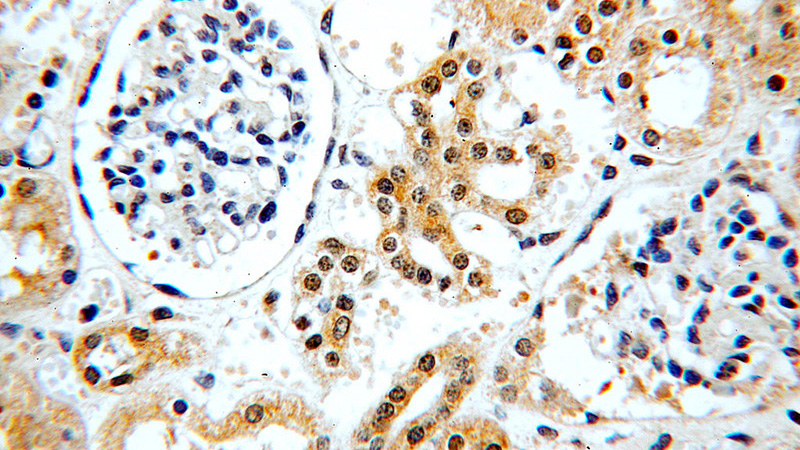 Immunohistochemical of paraffin-embedded human kidney using Catalog No:108738(C5orf44 antibody) at dilution of 1:50 (under 40x lens)