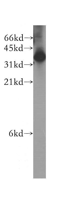 HEK-293 cells were subjected to SDS PAGE followed by western blot with Catalog No:110980(GIPC2 antibody) at dilution of 1:300