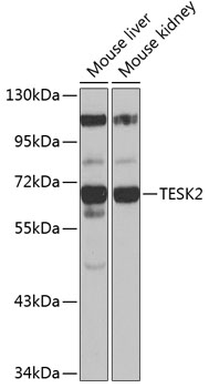 Western blot - TESK2 Polyclonal Antibody 