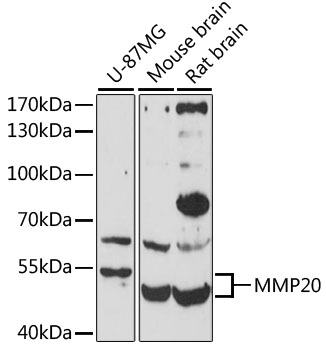 Western blot - MMP20 Polyclonal Antibody 