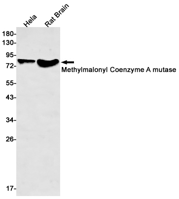 Western blot detection of Methylmalonyl Coenzyme A mutase in Hela,Rat Brain lysates using Methylmalonyl Coenzyme A mutase Rabbit mAb(1:500 diluted).Predicted band size:83kDa.Observed band size:83kDa.